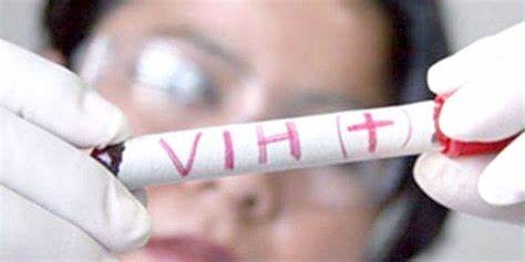 Sedes Tarija reporta 40 casos de VIH-SIDA en lo que va del año, la mayoría en personas jóvenes